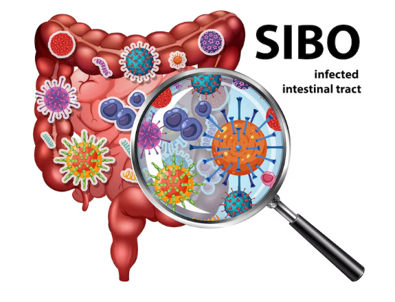 Sibo Diyeti-Dyt. Selin Söylemez sibo diyeti Dyt. Selin Söylemez